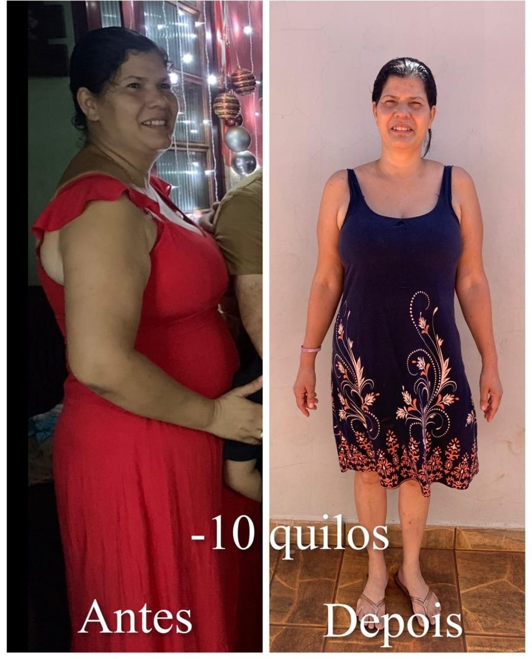 Antes e depois -10kg